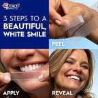Crest 3D Whitestrips Age Renewal | 24 behandlinger